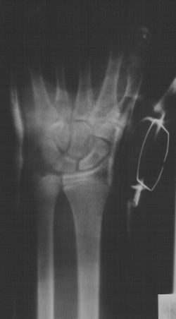 2002 02 15 15 58 20 706