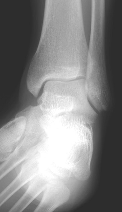 2002 02 18 22 30 51 706