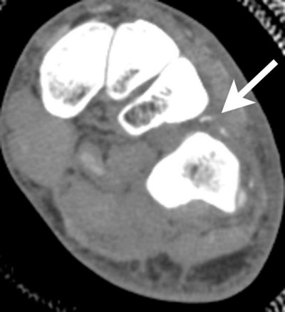 2002 02 18 22 31 16 706