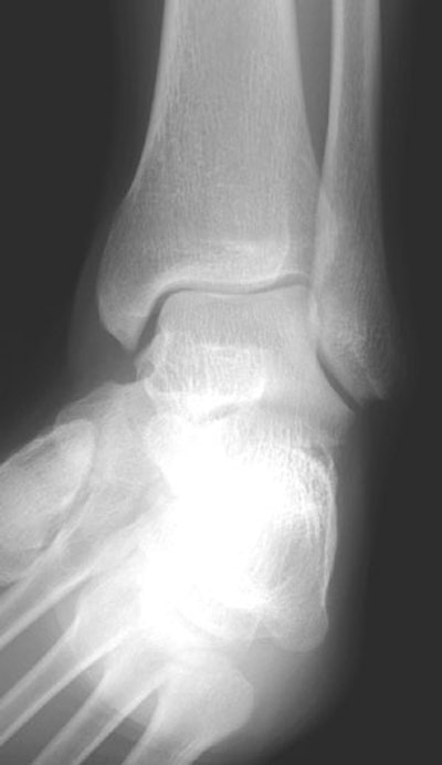 2002 02 19 19 27 46 706