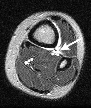 2002 02 19 19 28 28 706