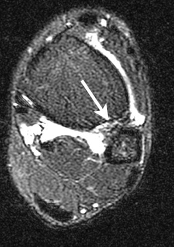 2002 02 19 19 29 08 706