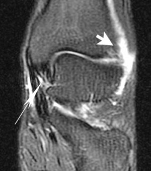 2002 02 19 19 29 44 706