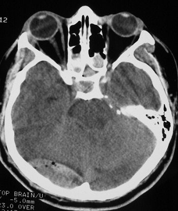 2002 02 20 18 15 17 706