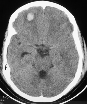 2002 02 20 18 15 57 706