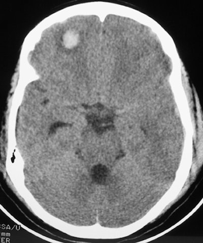 2002 02 20 18 15 57 706