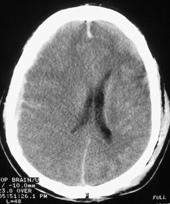 2002 02 20 18 16 26 706