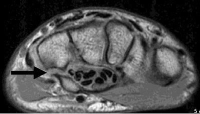 2002 02 21 17 33 21 706