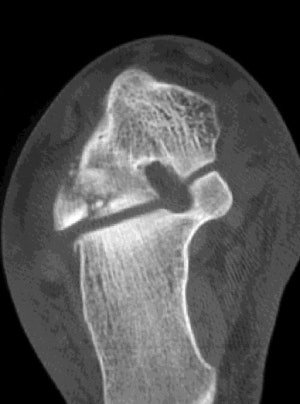 2002 02 22 18 19 31 706