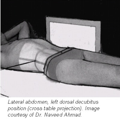 Patient setup with the abdominal compression device (a) located in