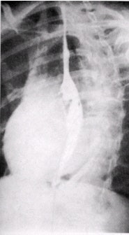 2002 03 19 16 20 17 706