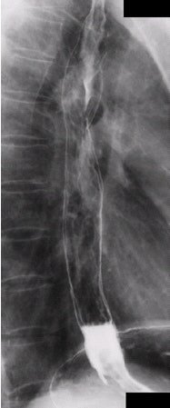 2002 03 19 16 30 10 706