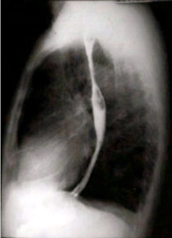 2002 03 19 16 36 45 706