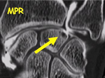 2002 03 21 15 07 36 706