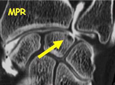 2002 03 21 15 07 36 706