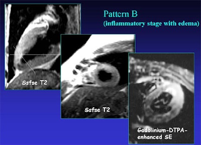 2002 03 29 11 54 06 706