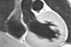 2002 03 29 12 17 19 706