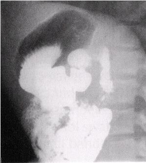 2002 04 16 15 28 10 706