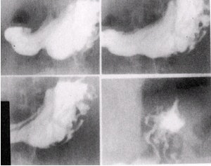 2002 04 16 15 41 07 706