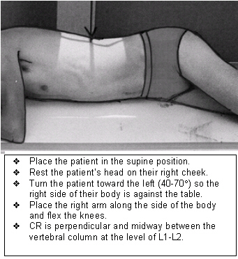 Patient positioning tips for a premium UGI series | AuntMinnie