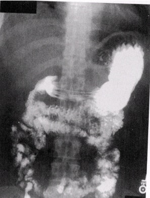 2002 04 16 16 03 07 706