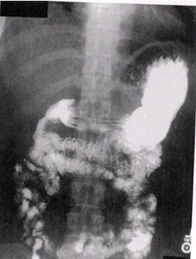 2002 04 16 16 03 07 706