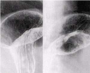 2002 04 16 16 08 27 706