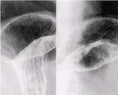 2002 04 16 16 08 27 706