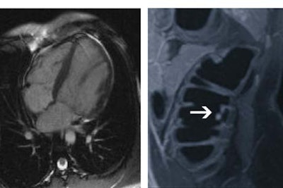 2002 04 17 12 29 41 706