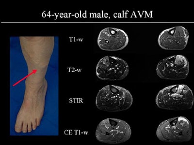 2002 04 24 11 22 44 706