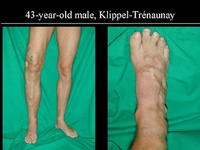 2002 04 24 11 23 18 706