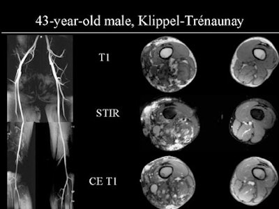 2002 04 24 11 23 43 706