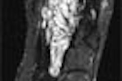 2002 04 24 11 35 56 706