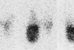 Autonomous_nodule_I123.JPG (11464 bytes)