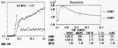 Baseline_curves.JPG (24008 bytes)
