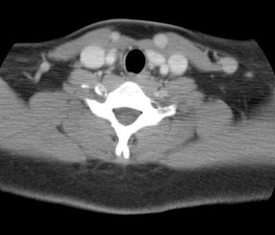 訳あってお買い得！30～80％OFF > imaging tumor PET > PET General AuntMinnie | シューズ