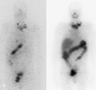 Bulkydz_123_pre_131_post.jpg (15428 bytes)