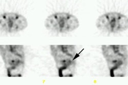 Cea Scan