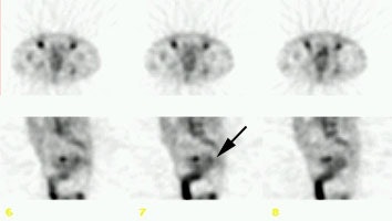 Cea Scan