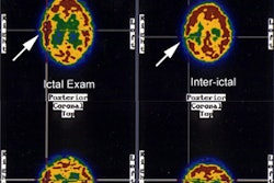 CNS seizure1_sm.JPG (50964 bytes)