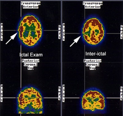 CNS seizure1_sm.JPG (50964 bytes)
