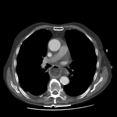 CT high.JPG (25280 bytes)