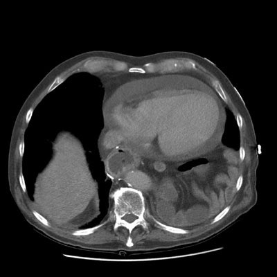 CT low.JPG (29153 bytes)