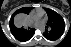 Ct Pre Contrast Small