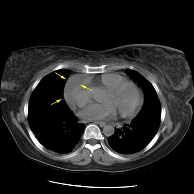 CT1 small.JPG (77952 bytes)