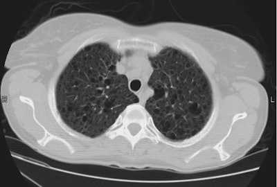 Ct1