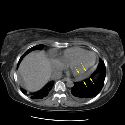 CT2 small.JPG (74404 bytes)