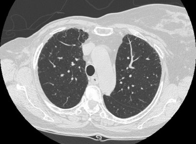 CT3 small.JPG (71322 bytes)