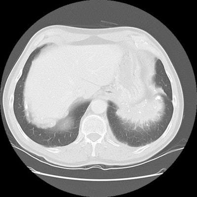 Ct3