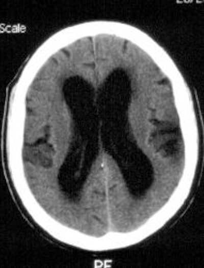 CT_1_sm.jpg (12131 bytes)